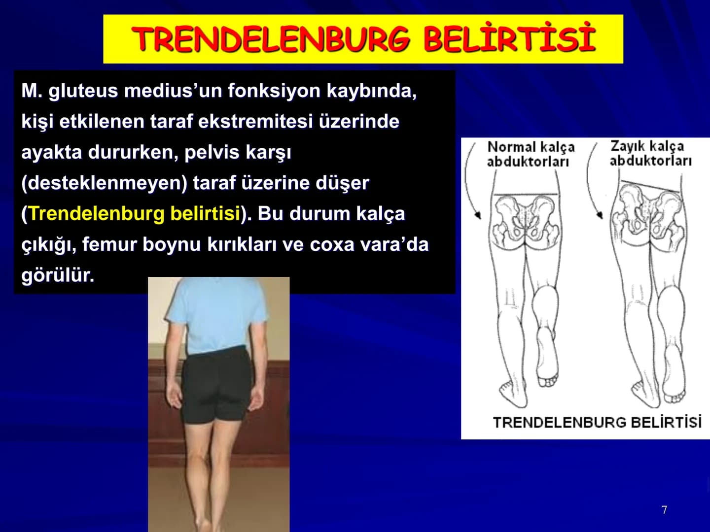 ALT TARAF KASLARI KALÇA KEMERİ KASLARI
ÖN GRUP
•
M.iliopsoas
-
-
-
- M.psoas major
⚫ Lumbal omurlardan başlar
M.iliacus
• Fossa iliaca'dan b