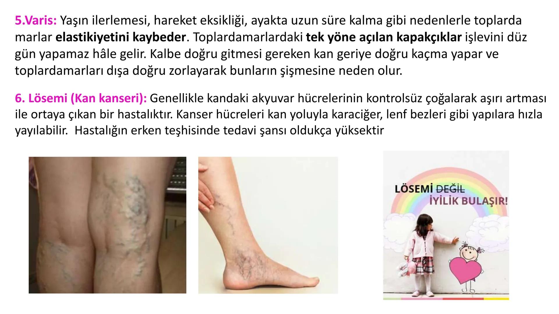 # Lenf Dolaşımı

1. Kılcal damarların atardamar ucundan boşluğa geçen sıvının tamamı, toplardamar ucundan
kılcala geri emilemez ve bazı küçü