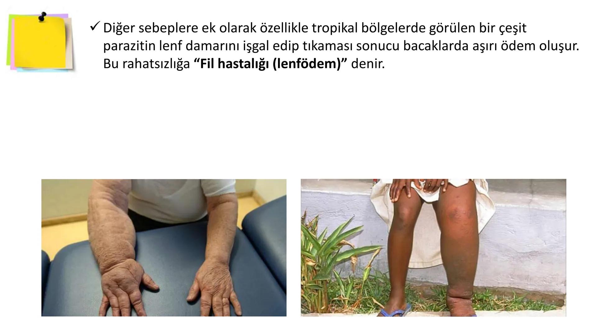 # Lenf Dolaşımı

1. Kılcal damarların atardamar ucundan boşluğa geçen sıvının tamamı, toplardamar ucundan
kılcala geri emilemez ve bazı küçü