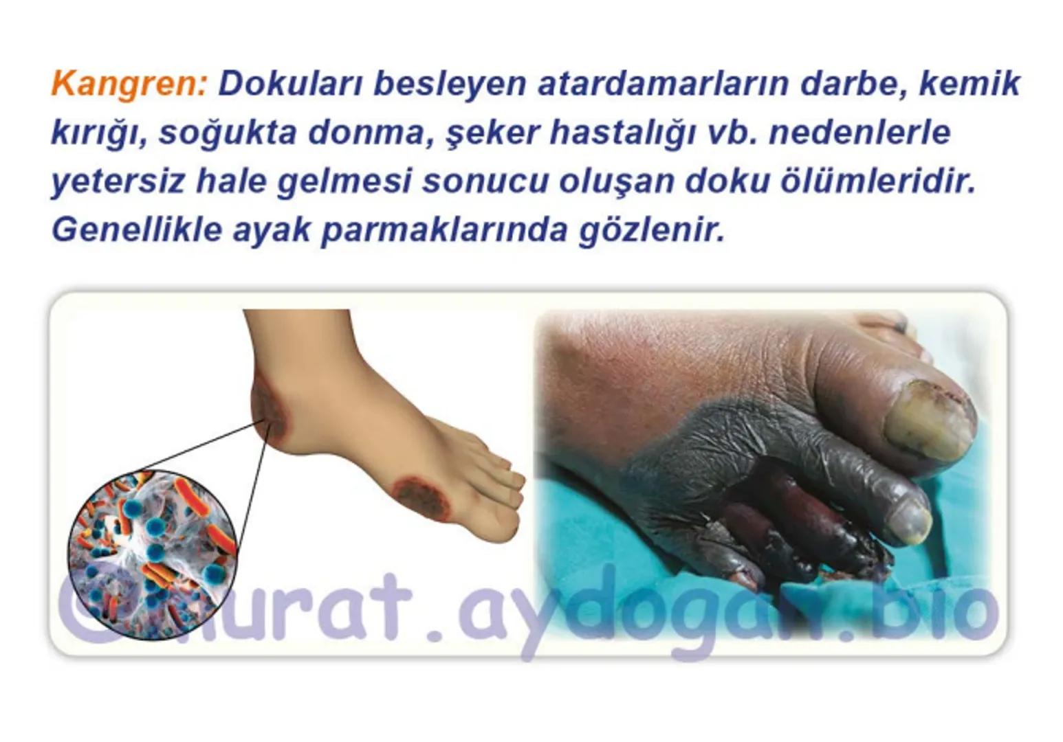 Kalbin Yapısı: Kalp iki kulakçık ve iki karıncıktan oluşur.
Kulakçıklar toplardamarlarla, karıncıklar atardamarlarla
bağlantılıdır. @Murat.a