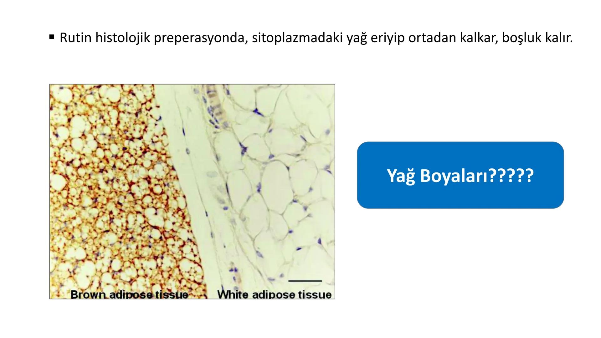 BAĞ DOKU
Doç. Dr. Sanem SARIBAŞ
SBÜ Gülhane Tıp Fakültesi
Histoloji ve Embriyoloji AD Örtü Epiteli
Bağ Doku
Bez Epiteli Bağ doku mezoderm or
