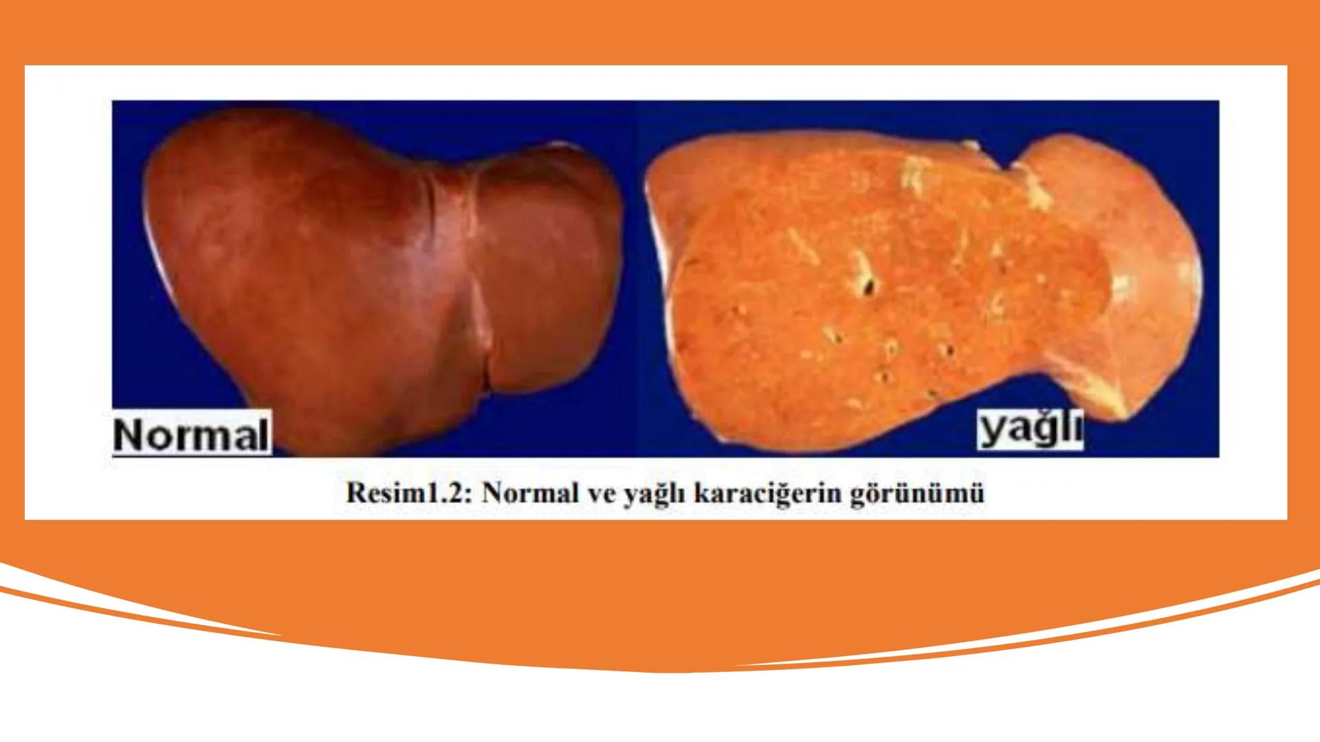 SİNDİRİM
SİSTEMİNE
ETKİLİ İLAÇLAR # SİNDİRİM SİSTEMİNE ETKİLİ İLAÇLAR
Sindirim sistemi ağızdan
başlayıp anüse kadar uzanan
ve yer yer geniş