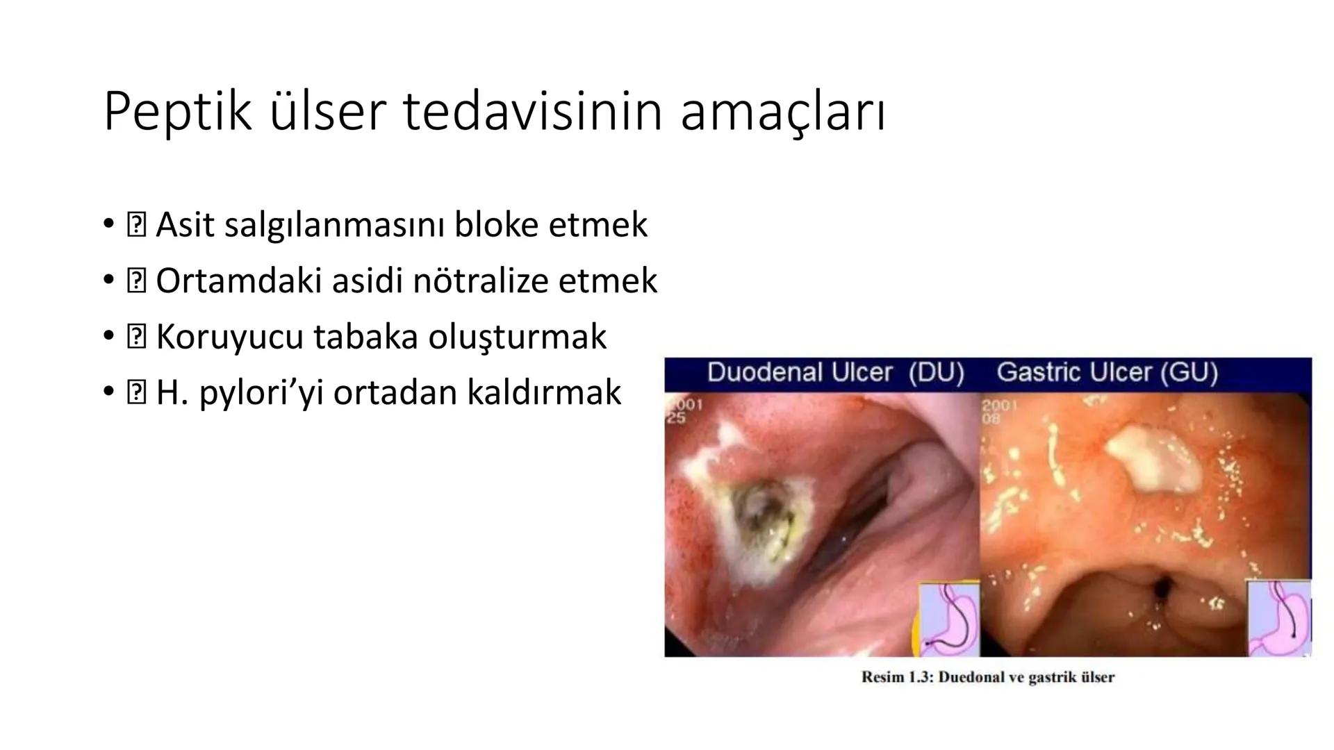 SİNDİRİM
SİSTEMİNE
ETKİLİ İLAÇLAR # SİNDİRİM SİSTEMİNE ETKİLİ İLAÇLAR
Sindirim sistemi ağızdan
başlayıp anüse kadar uzanan
ve yer yer geniş